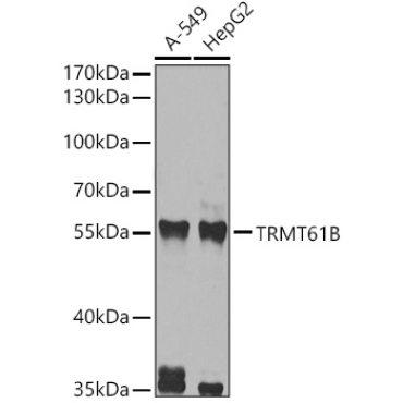 TRMT61B Rabbit Polyclonal Antibody