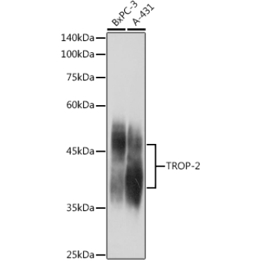 TROP-2 Rabbit Polyclonal Antibody