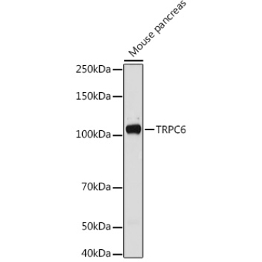 TRPC6 Rabbit Polyclonal Antibody