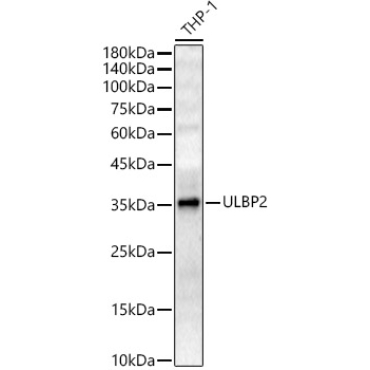 ULBP2 Rabbit Polyclonal Antibody
