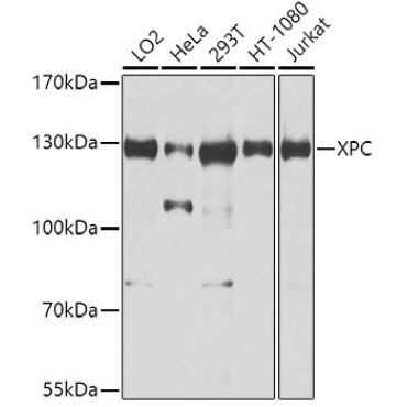 XPC Rabbit Polyclonal Antibody