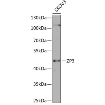 ZP3 Rabbit Polyclonal Antibody