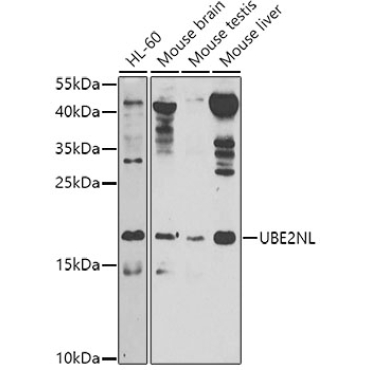 UBE2NL Rabbit Polyclonal Antibody