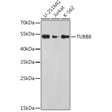 TUBB8 Rabbit Polyclonal Antibody