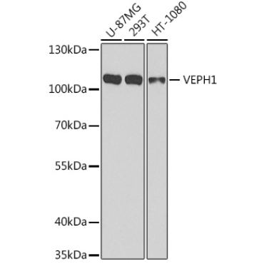 VEPH1 Rabbit Polyclonal Antibody