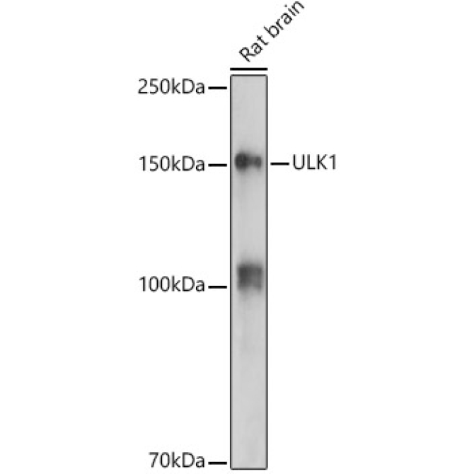 ULK1 Rabbit Polyclonal Antibody