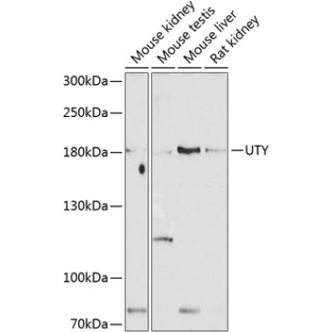 UTY Rabbit Polyclonal Antibody