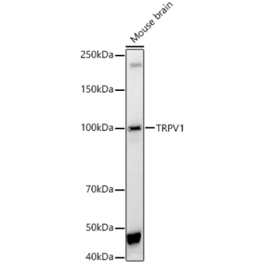 TRPV1 Rabbit Polyclonal Antibody