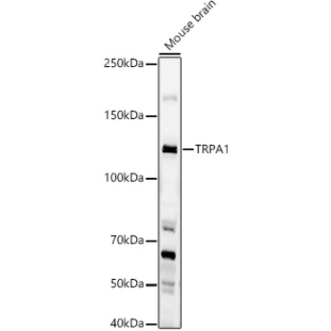TRPA1 Rabbit Polyclonal Antibody