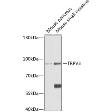 TRPV3 Rabbit Polyclonal Antibody