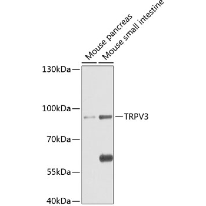 TRPV3 Rabbit Polyclonal Antibody