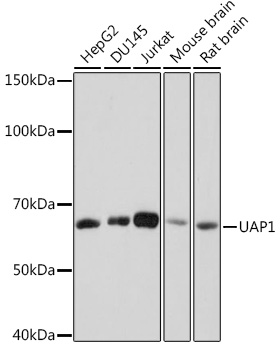 UAP1 Rabbit Monoclonal Antibody