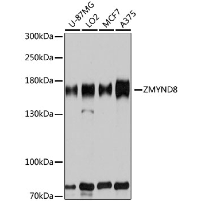 ZMYND8 Rabbit Polyclonal Antibody