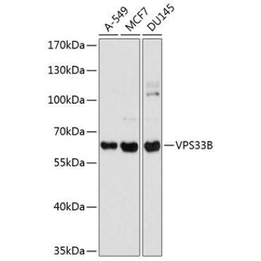 VPS33B Rabbit Polyclonal Antibody