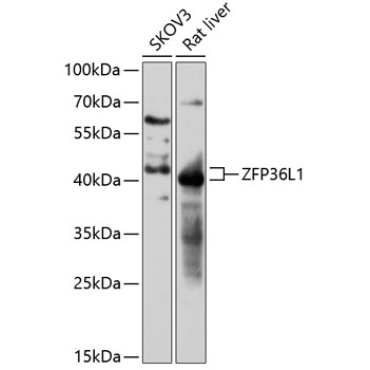 ZFP36L1 Rabbit Polyclonal Antibody