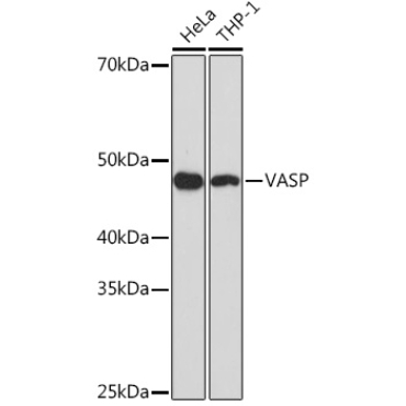 VASP Rabbit Monoclonal Antibody