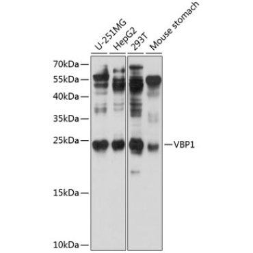 VBP1 Rabbit Polyclonal Antibody