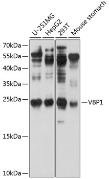 VBP1 Rabbit Polyclonal Antibody