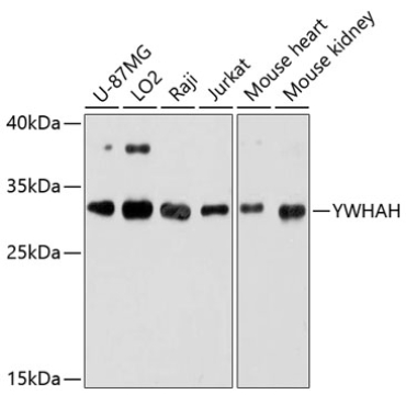 YWHAH Rabbit Polyclonal Antibody