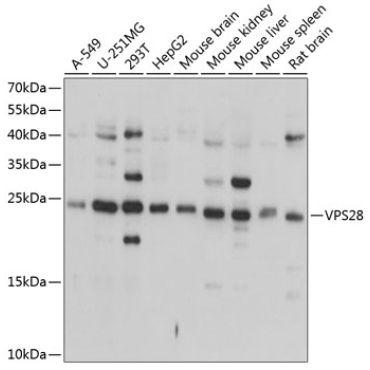 VPS28 Rabbit Polyclonal Antibody