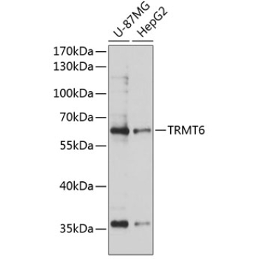 TRMT6 Rabbit Polyclonal Antibody