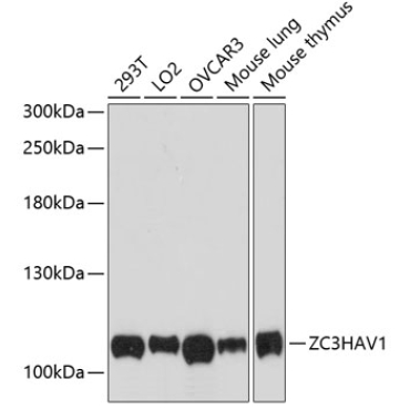 ZC3HAV1 Rabbit Polyclonal Antibody