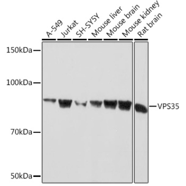 VPS35 Rabbit Monoclonal Antibody