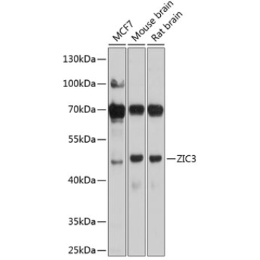 ZIC3 Rabbit Polyclonal Antibody
