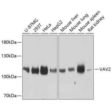 VAV2 Rabbit Polyclonal Antibody