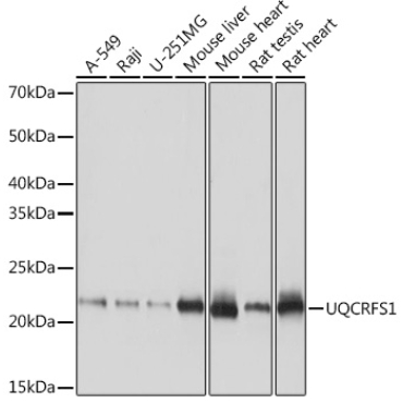 UQCRFS1 Rabbit Monoclonal Antibody