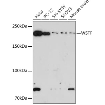 WSTF Rabbit Monoclonal Antibody