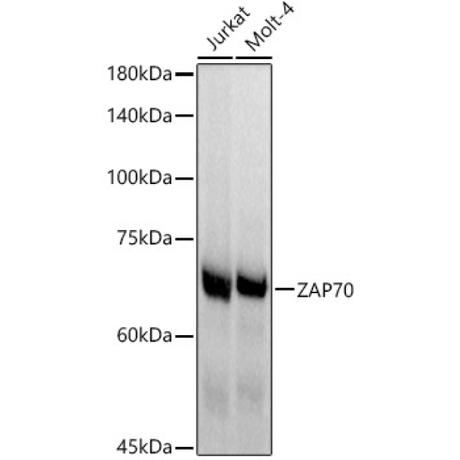 ZAP70 Rabbit Monoclonal Antibody