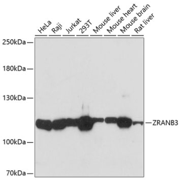 ZRANB3 Rabbit Polyclonal Antibody