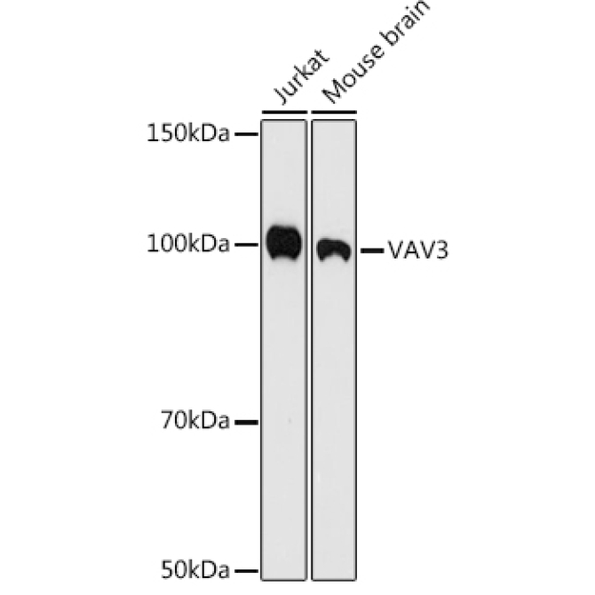 VAV3 Rabbit Monoclonal Antibody