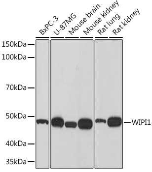 WIPI1 Rabbit Monoclonal Antibody