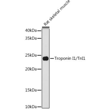 Troponin I1/TnI1 Rabbit Monoclonal Antibody