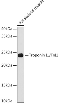 Troponin I1/TnI1 Rabbit Monoclonal Antibody