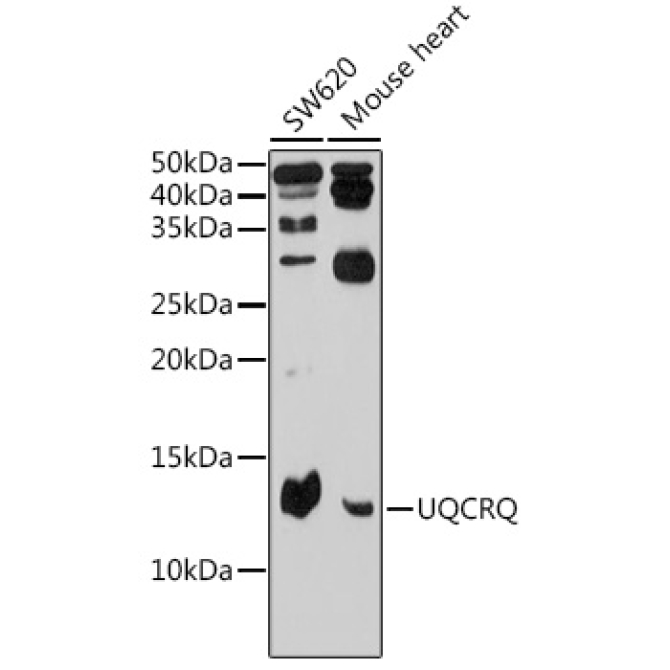 UQCRQ Rabbit Polyclonal Antibody