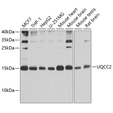 UQCC2 Rabbit Polyclonal Antibody