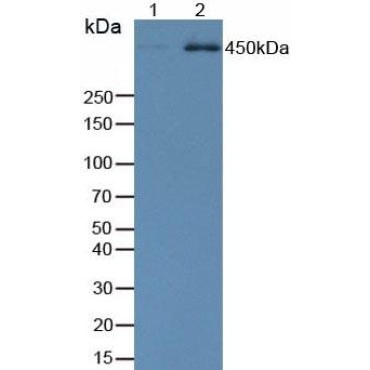 Anti-Phosphorylated Tumor Protein p53 Binding Protein 1 (TP53BP1) Human Monoclonal Antibody