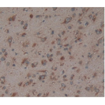 Anti-Calnexin (CNX) Human Polyclonal Antibody