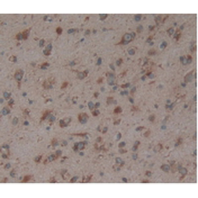 Anti-Calnexin (CNX) Human Polyclonal Antibody