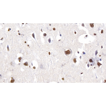 Anti-Histone H3 (H3) Human Polyclonal Antibody