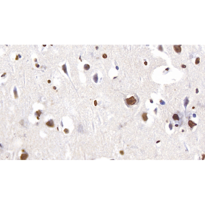 Anti-Histone H3 (H3) Human Polyclonal Antibody