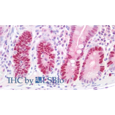 Anti-Proliferating Cell Nuclear Antigen (PCNA) Human Polyclonal Antibody