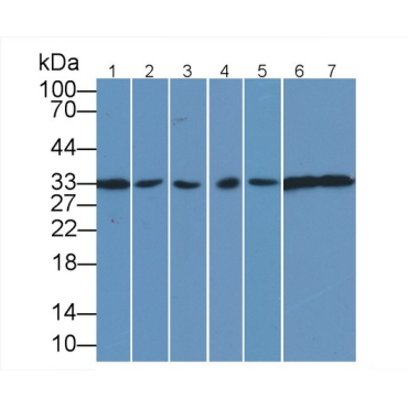 Anti-Proliferating Cell Nuclear Antigen (PCNA) Human Monoclonal Antibody