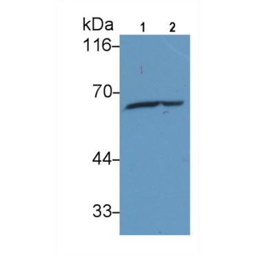Anti-Heat Shock Protein 60 (Hsp60) Human Monoclonal Antibody
