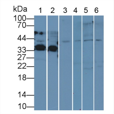 Anti-Extracellular Signal Regulated Kinase 2 (ERK2) Human Polyclonal Antibody