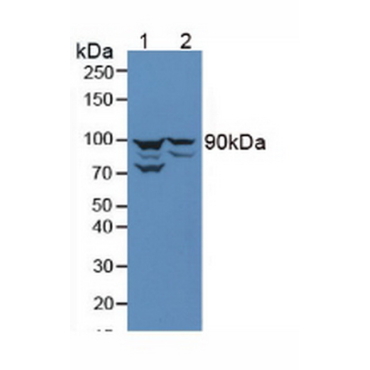 Anti-Beta Catenin (Beta-catenin) Human Polyclonal Antibody