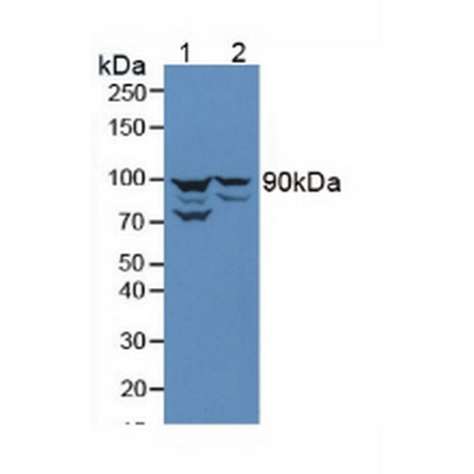 Anti-Beta Catenin (Beta-catenin) Human Polyclonal Antibody
